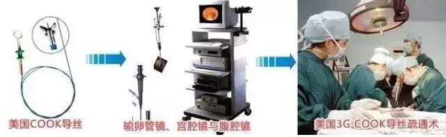 治愈不孕不育的“金钥匙” 宫腹腔镜联合COOK导丝(图2)